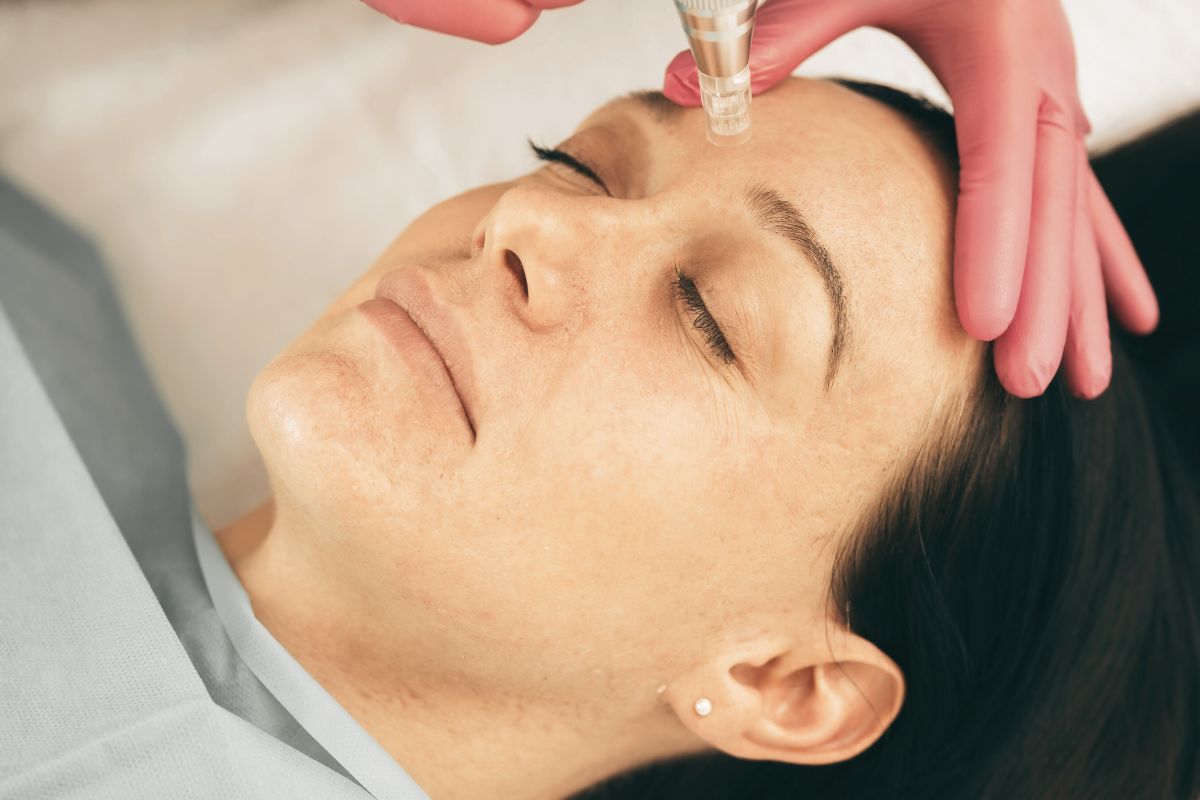 HIFU Facial Tightening